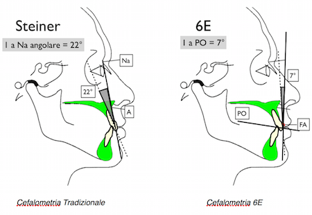 cefalometria tradizionale, cefalometria 6 elementi 