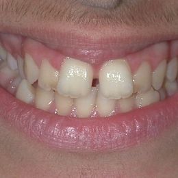0020sorriso 1a