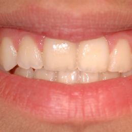 0030sorriso 1b