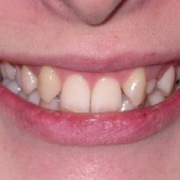 0040sorriso 13a