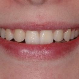 0041sorriso 13b