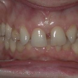 sorriso 11a