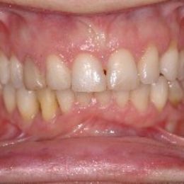 sorriso 11b