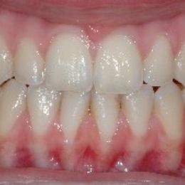 sorriso 14b