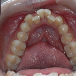 sorriso 7a