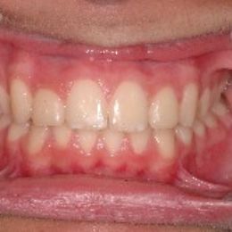 sorriso 8b