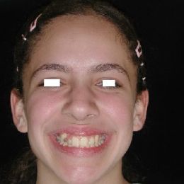 sorriso 9a