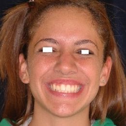 sorriso 9b