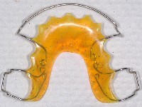 apparecchi di contenzione, Hawley retainer