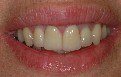 protesi dentale, ortodonzia preprotesica, estetica dentale