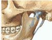 Le osteoartriti e le osteoartrosi dell'articolazione temporo-mandibolare