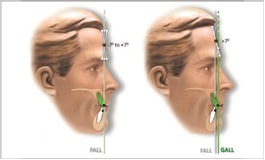 element II jaws anterior, 6 Elements Philosophy, L. Andrews