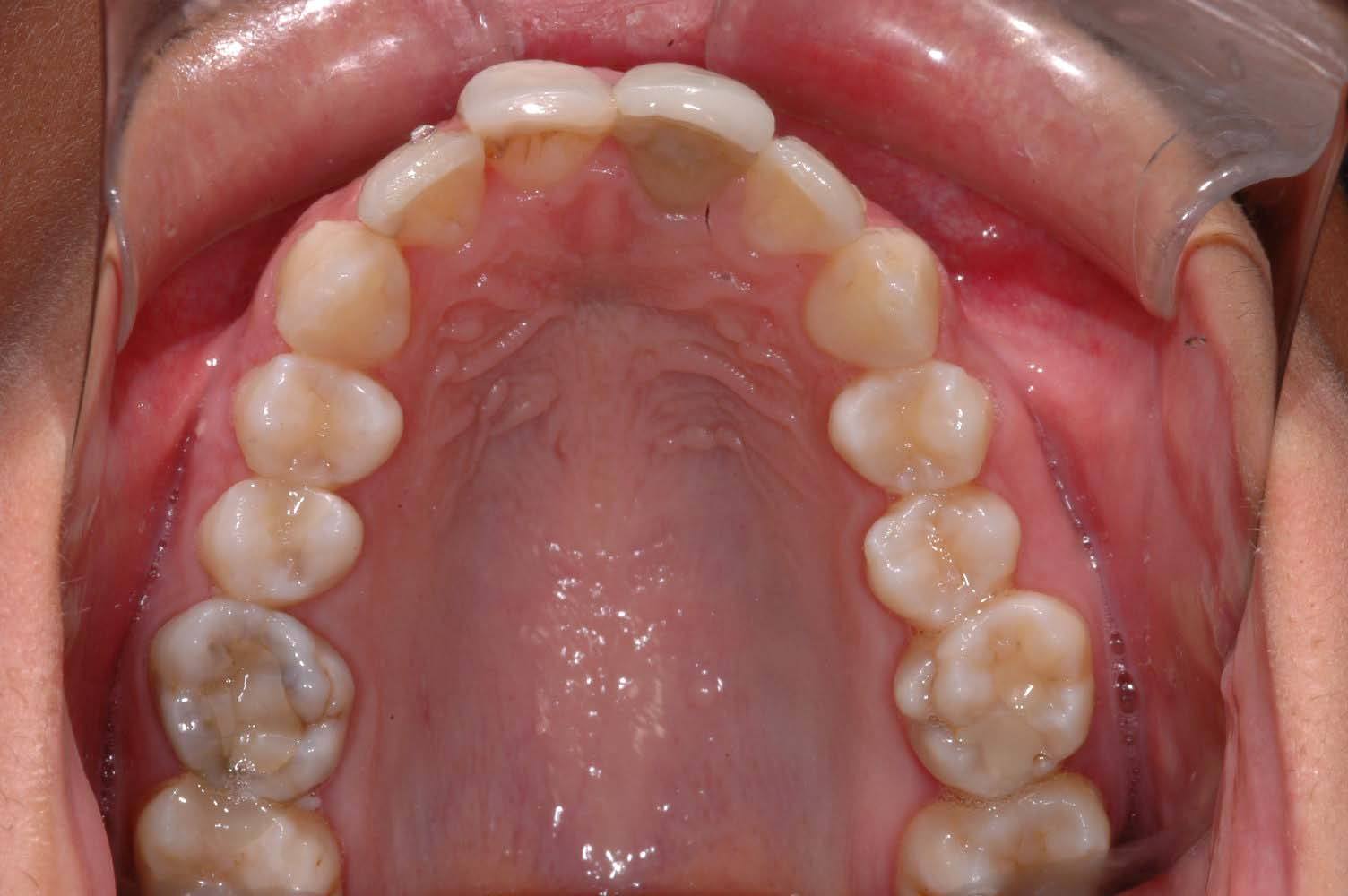 ortodonzia, apparecchio per i denti